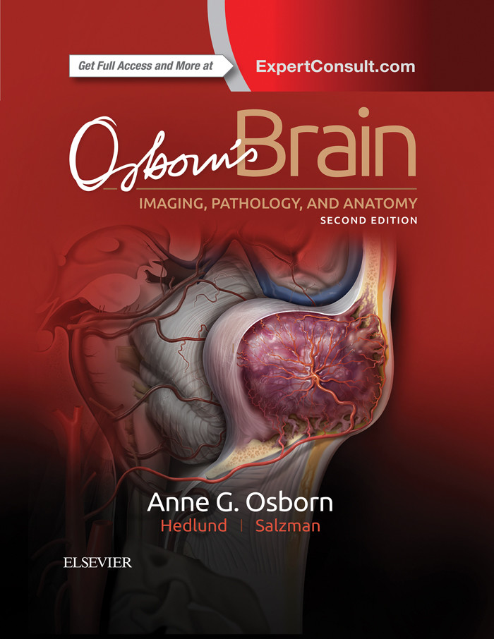 Cover Osborn's Brain E-Book