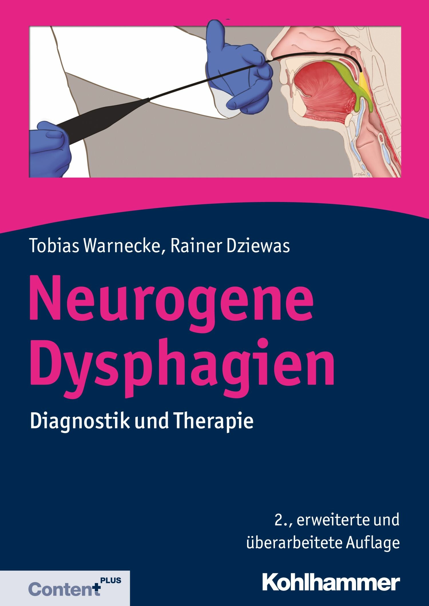 Cover Neurogene Dysphagien
