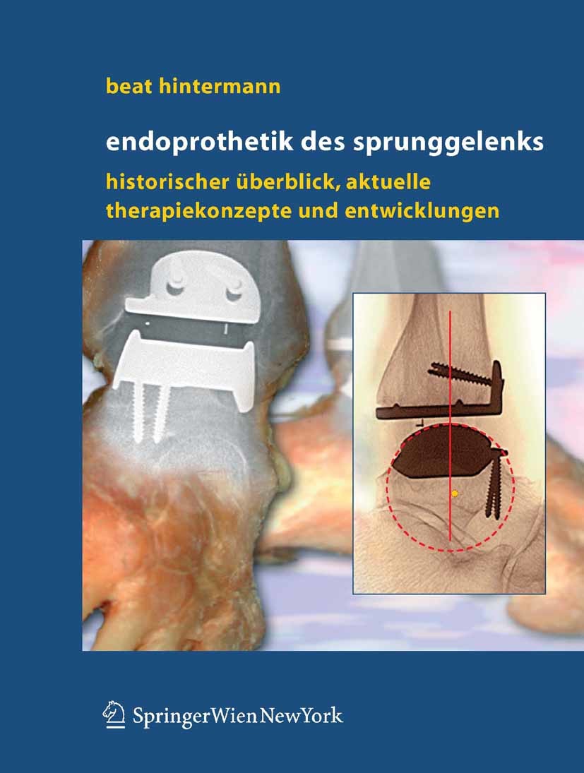 Cover Endoprothetik des Sprunggelenks