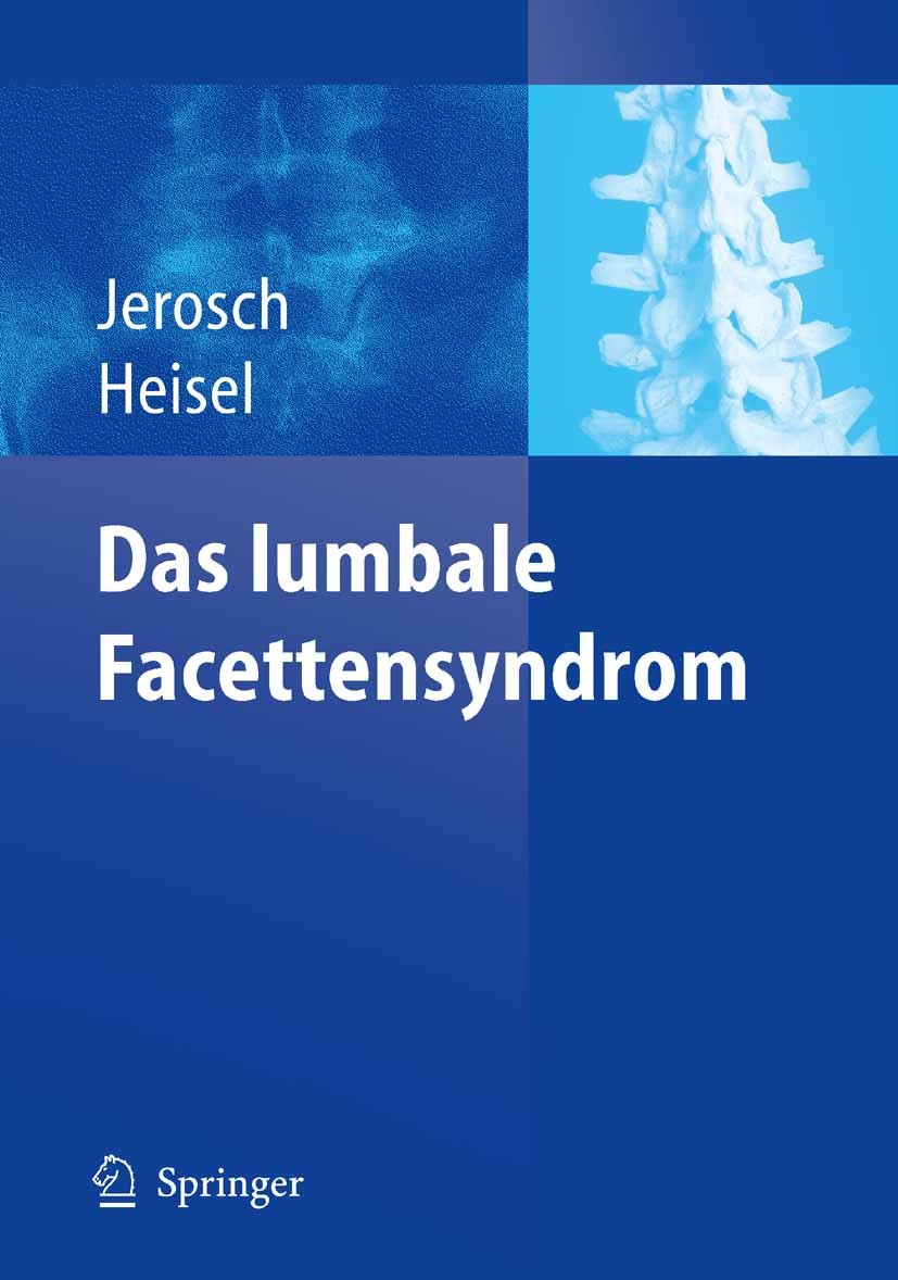 Cover Das lumbale Facettensyndrom