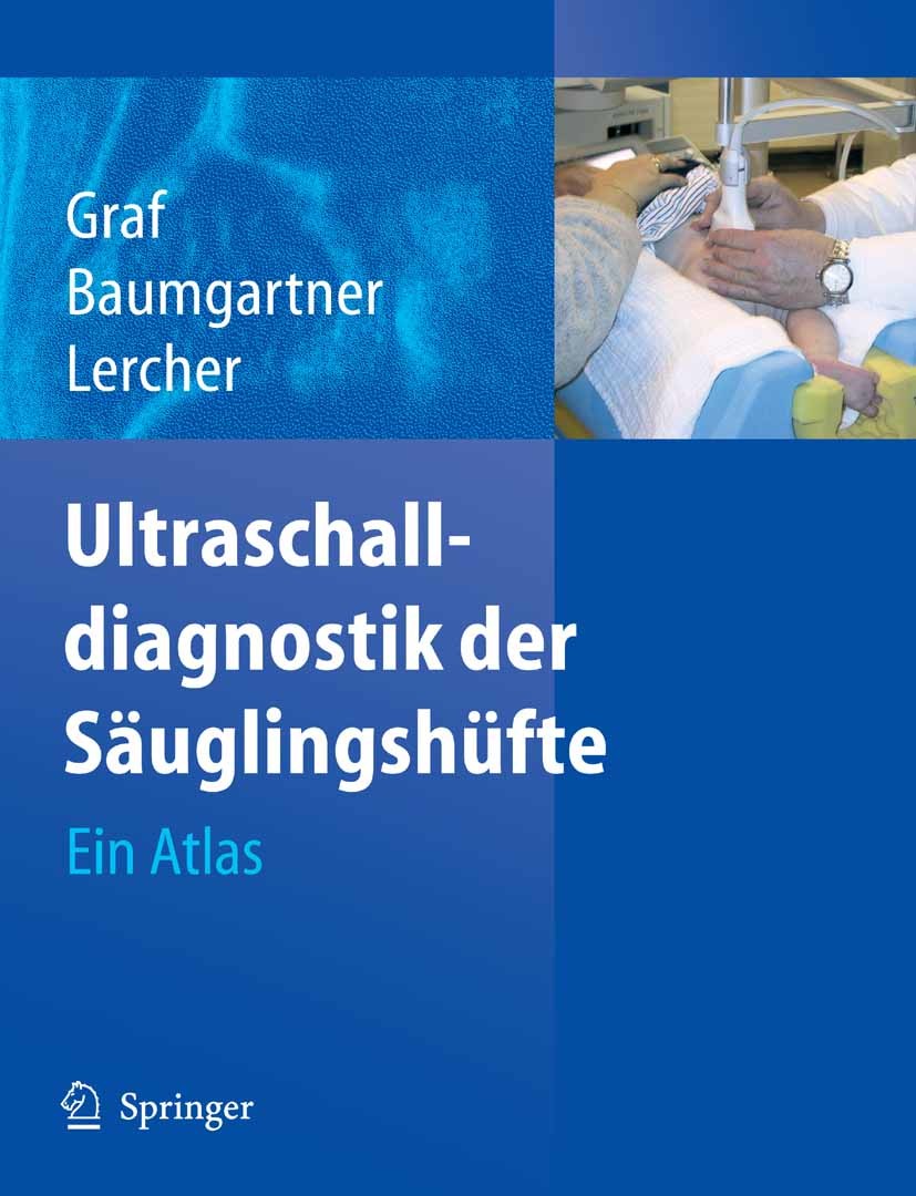 Cover Ultraschalldiagnostik der Säuglingshüfte
