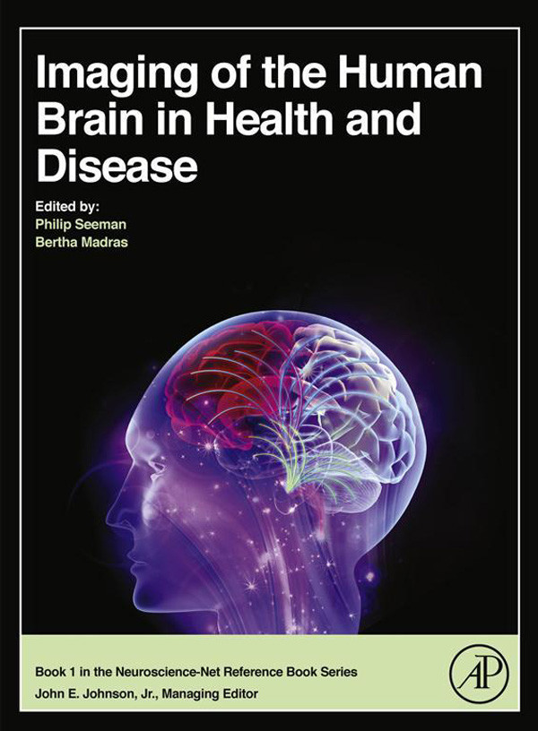 Cover Imaging of the Human Brain in Health and Disease
