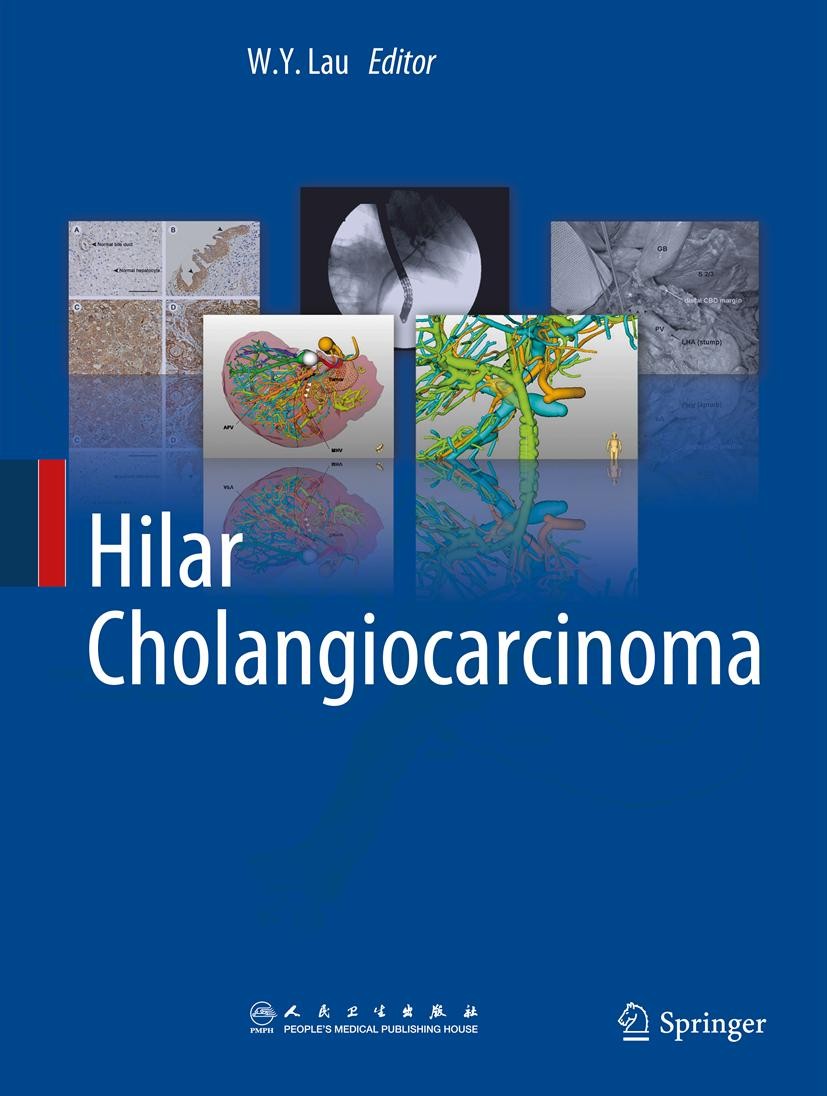Cover Hilar Cholangiocarcinoma