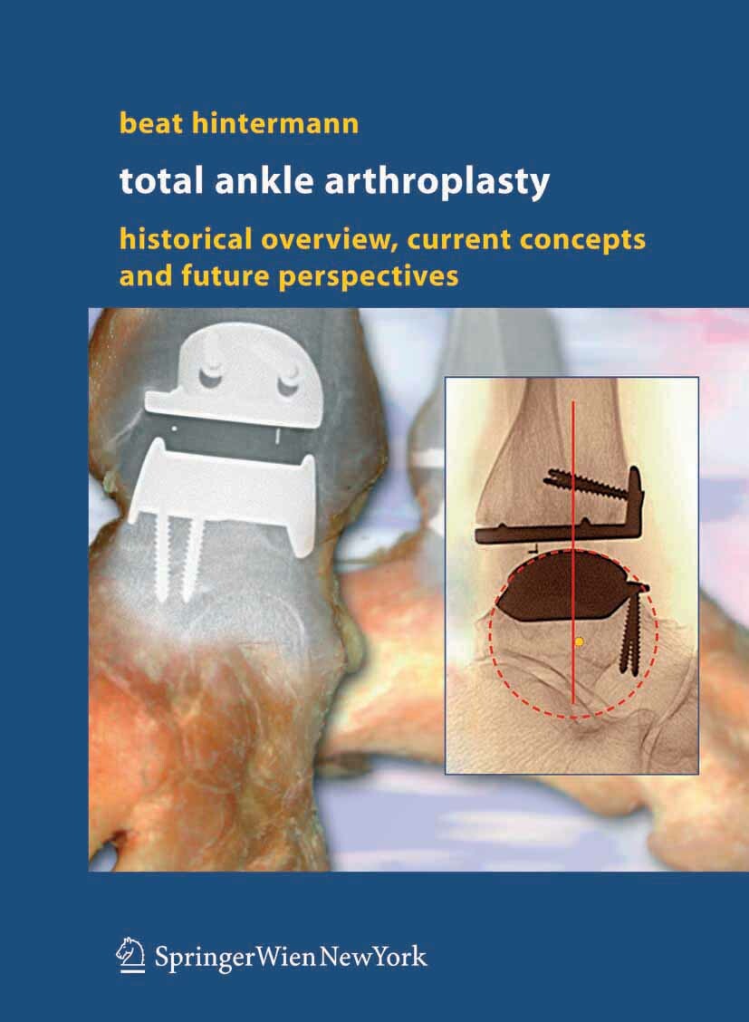 Cover Total Ankle Arthroplasty