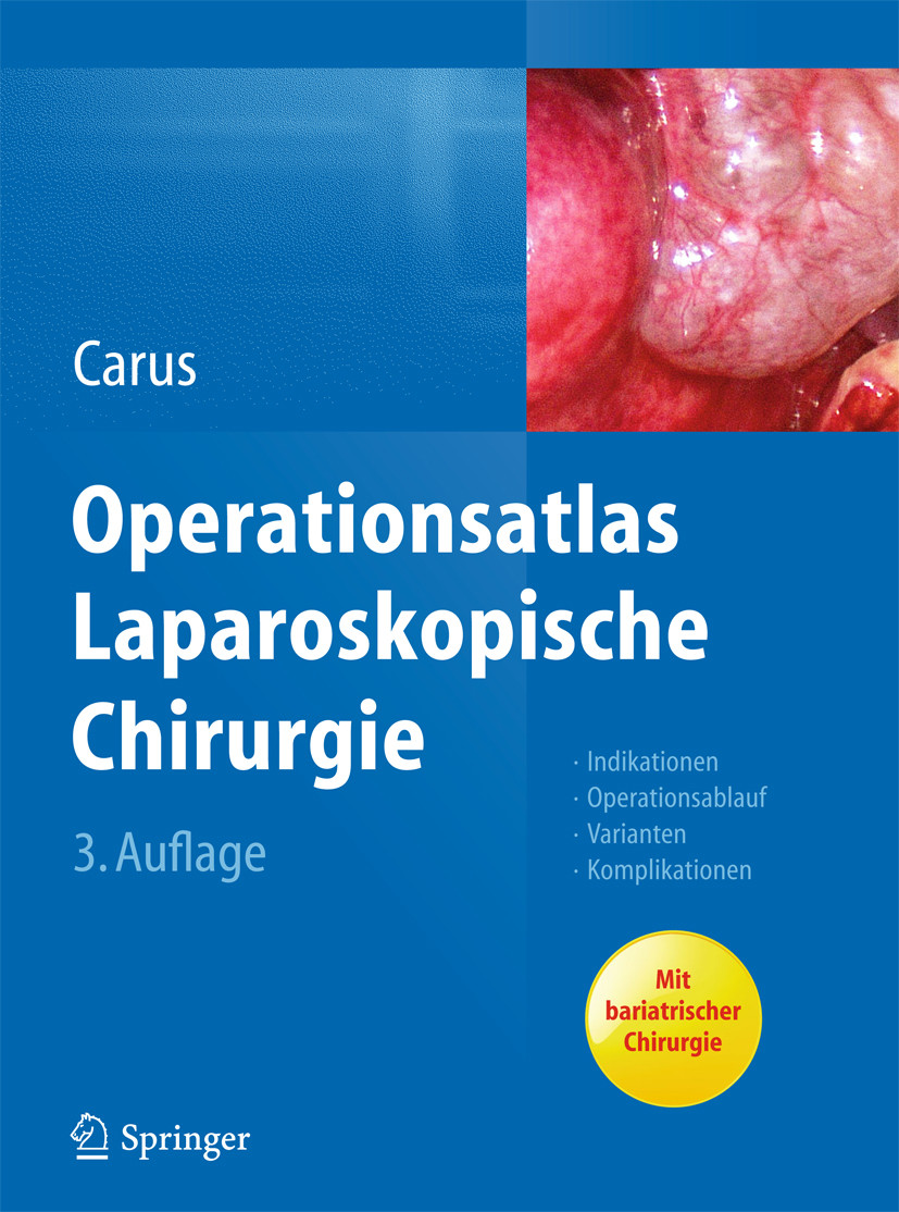 Cover Operationsatlas Laparoskopische Chirurgie