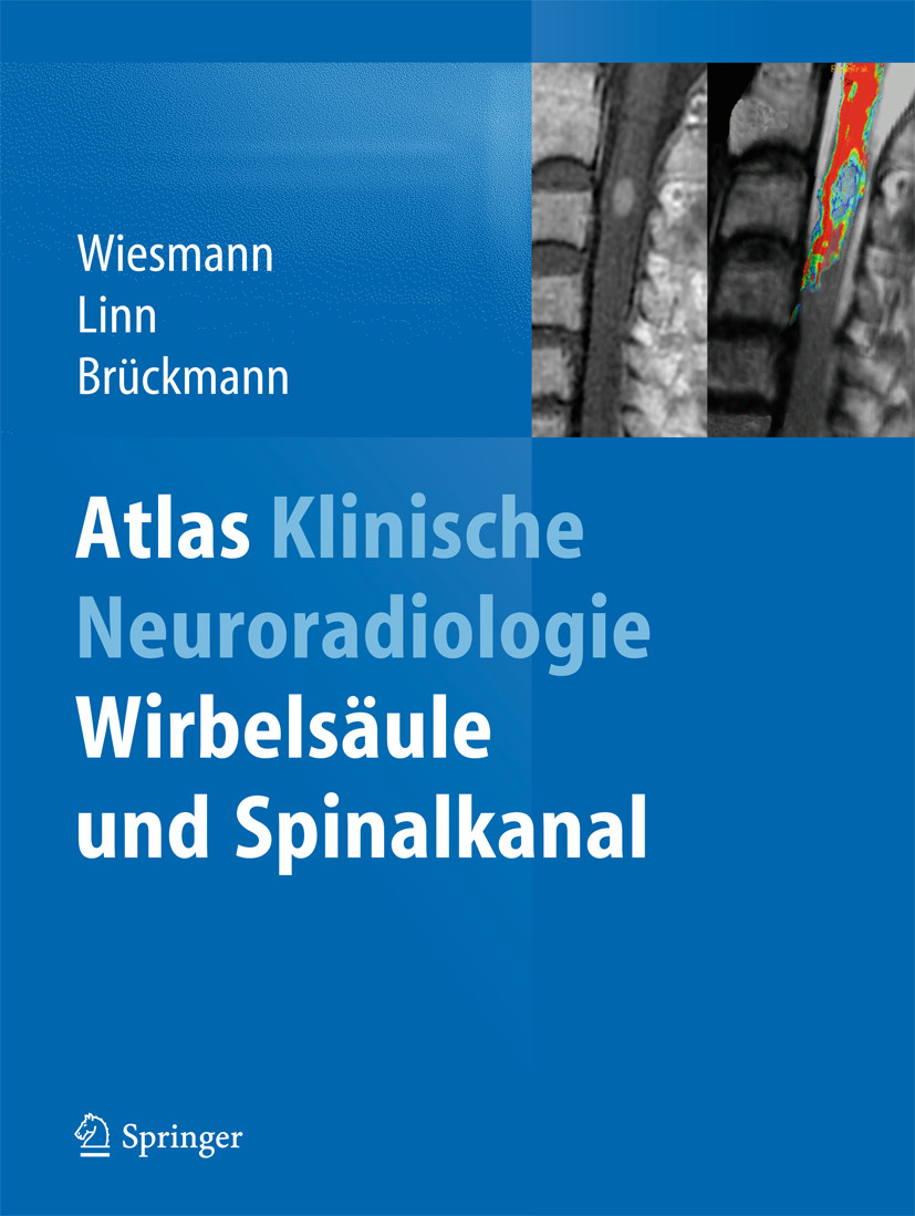 Cover Atlas Klinische Neuroradiologie