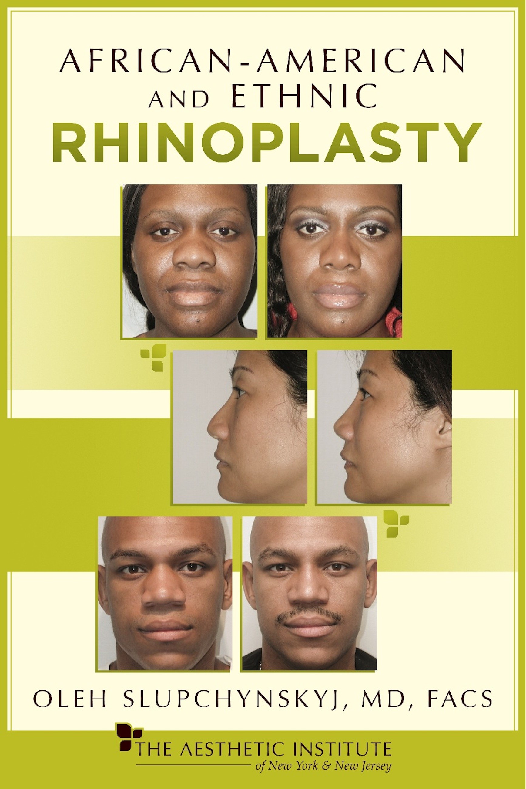 Cover African-American and Ethnic Rhinoplasty