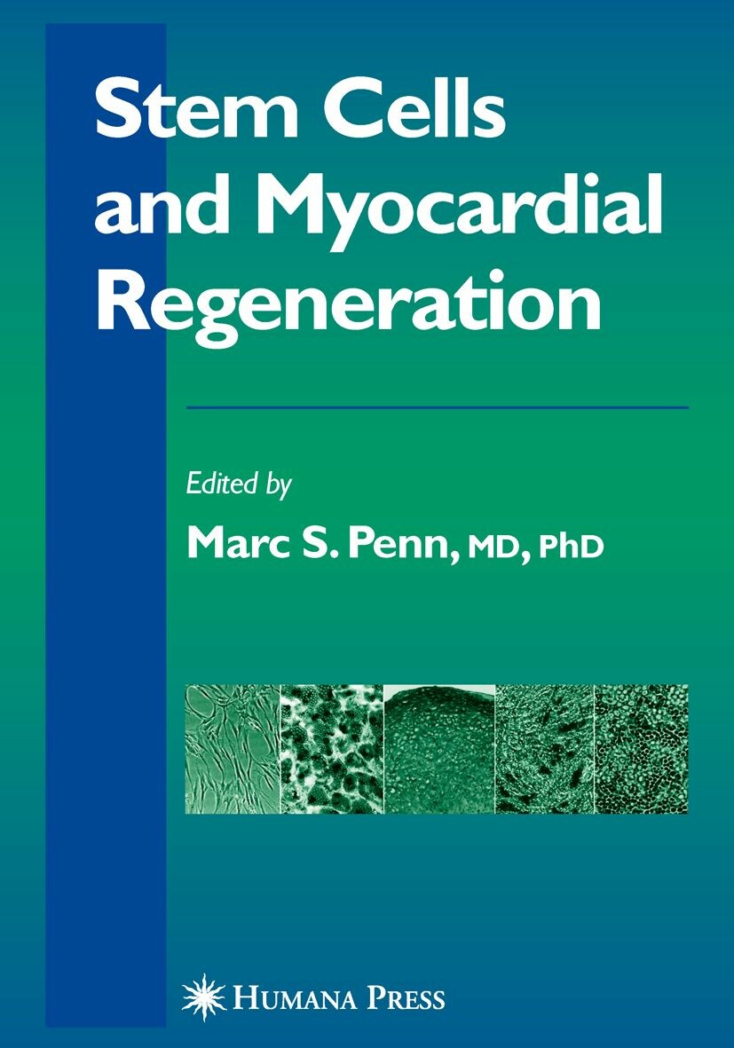 Cover Stem Cells and Myocardial Regeneration