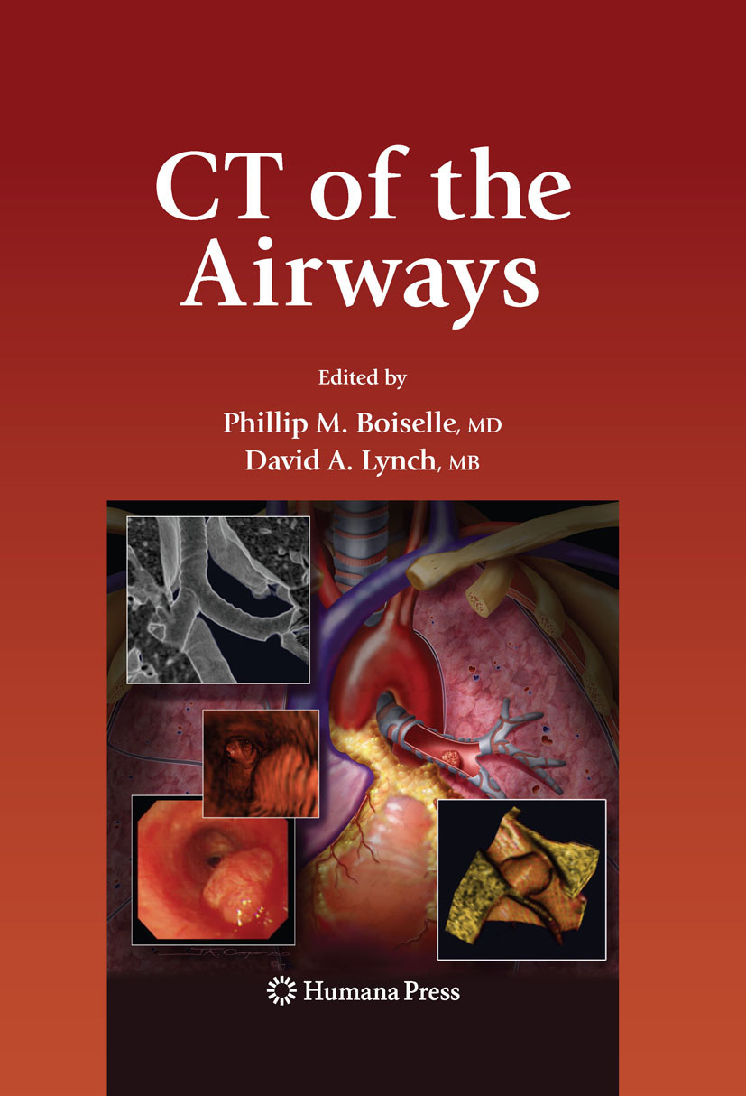 Cover CT of the Airways