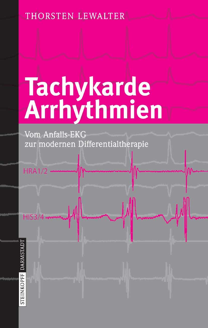 Cover Tachykarde Arrhythmien