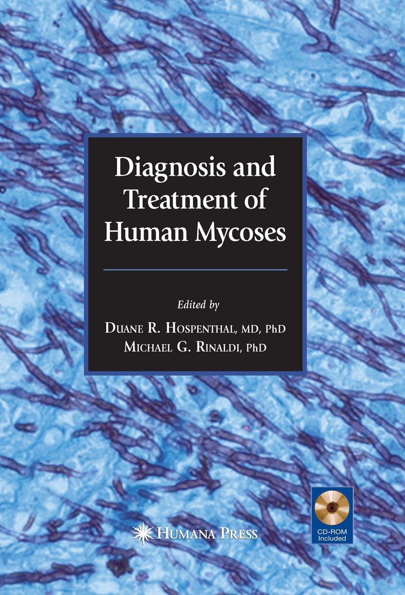 Cover Diagnosis and Treatment of Human Mycoses