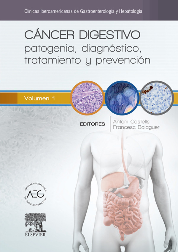 Cáncer Digestivo: Patogenia, Diagnóstico, Tratamiento Y Prevención - E-Book