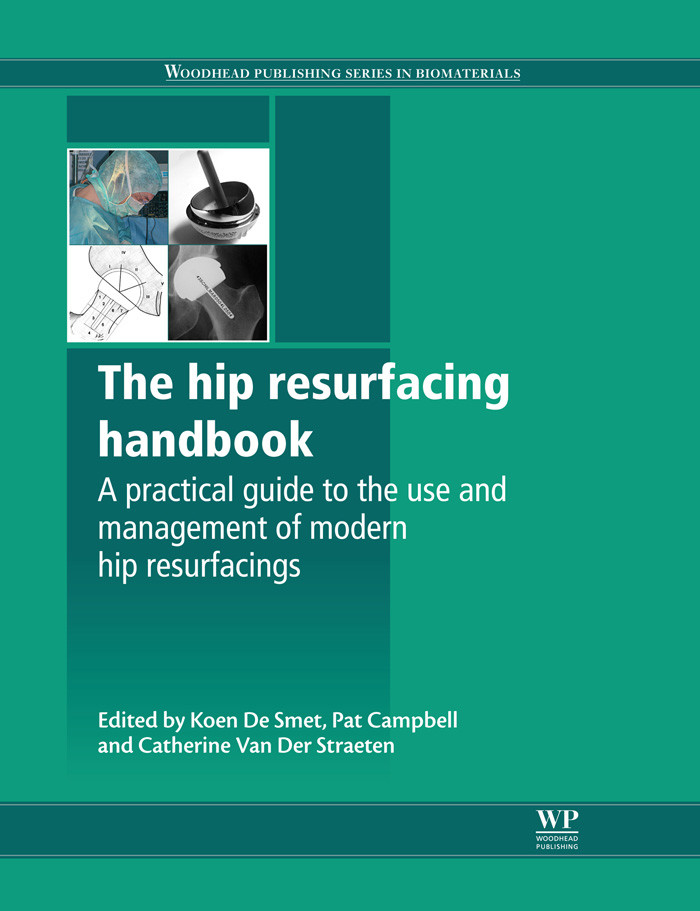 Cover The Hip Resurfacing Handbook