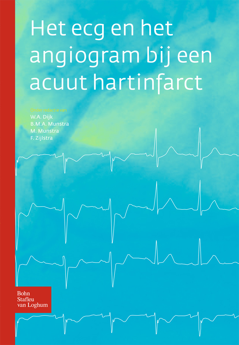 Cover Het ecg en het angiogram bij een acuut hartinfarct