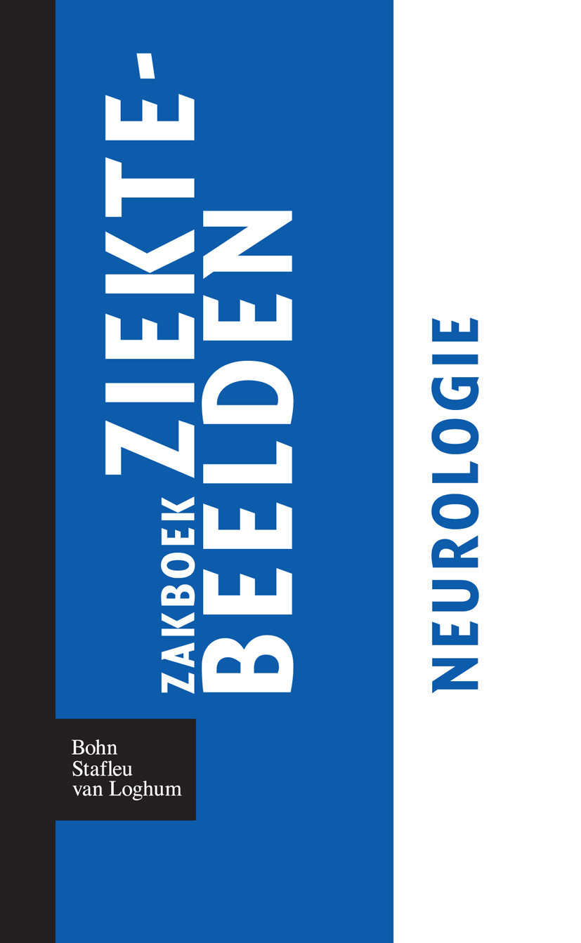 Cover Zakboek ziektebeelden Neurologie