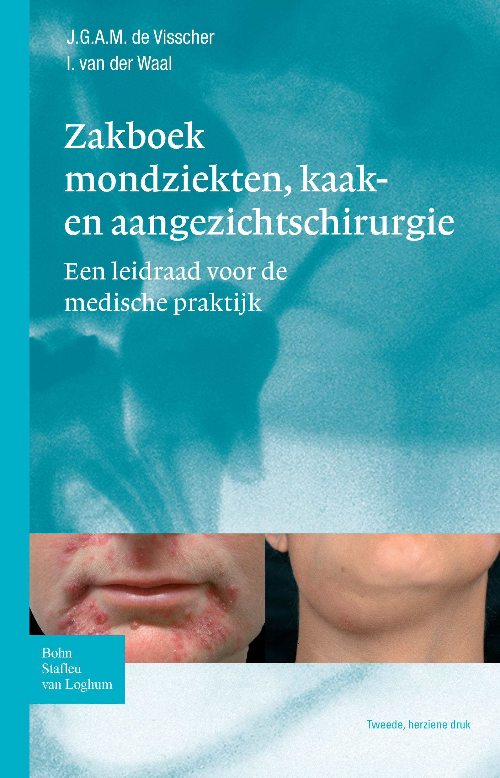 Zakboek Mondziekten, Kaak- En Aangezichtschirurgie - E-Book