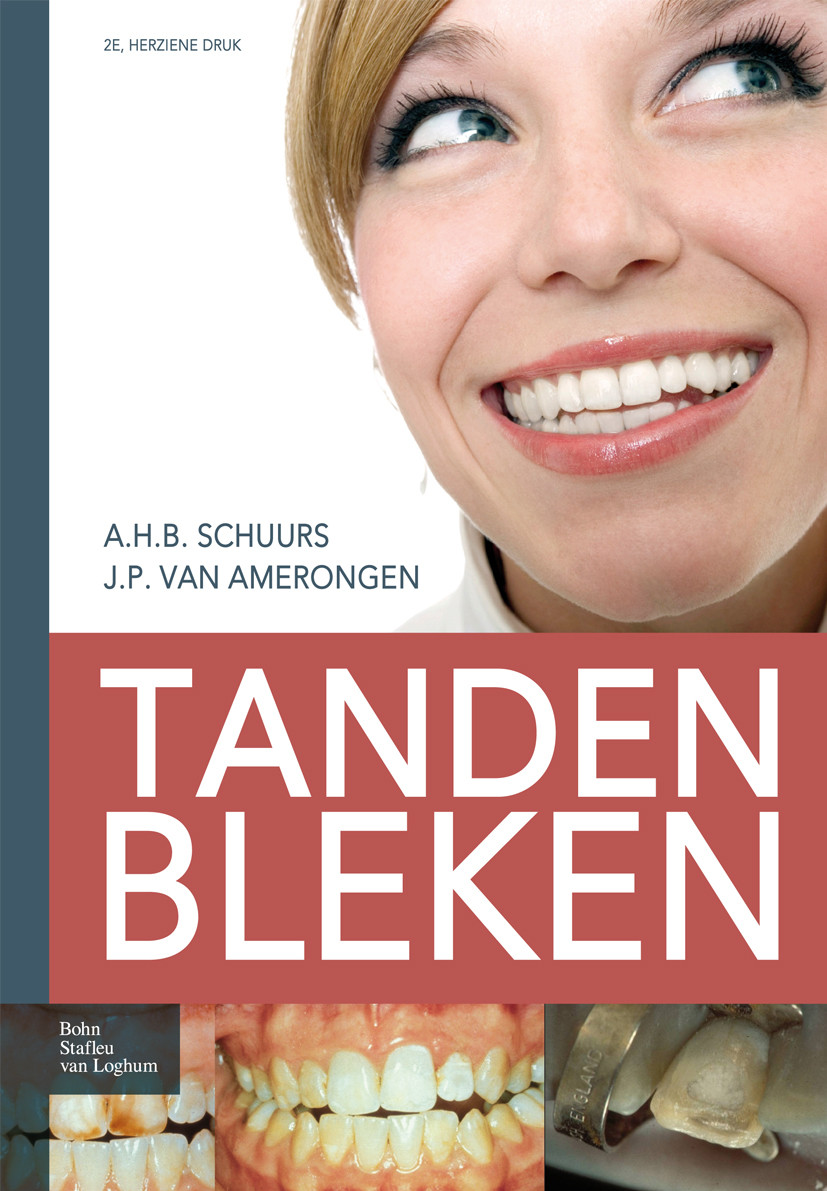 Cover Tanden bleken