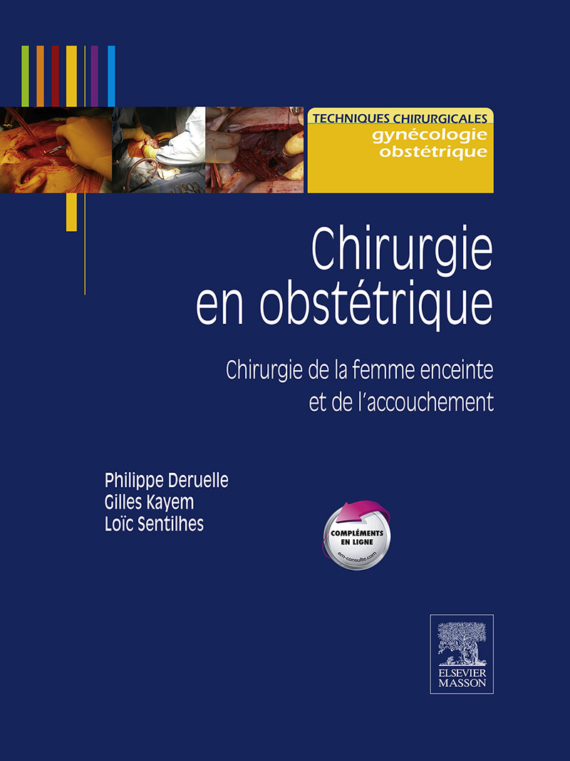 Chirurgie En Obstétrique - E-Book - Frohberg