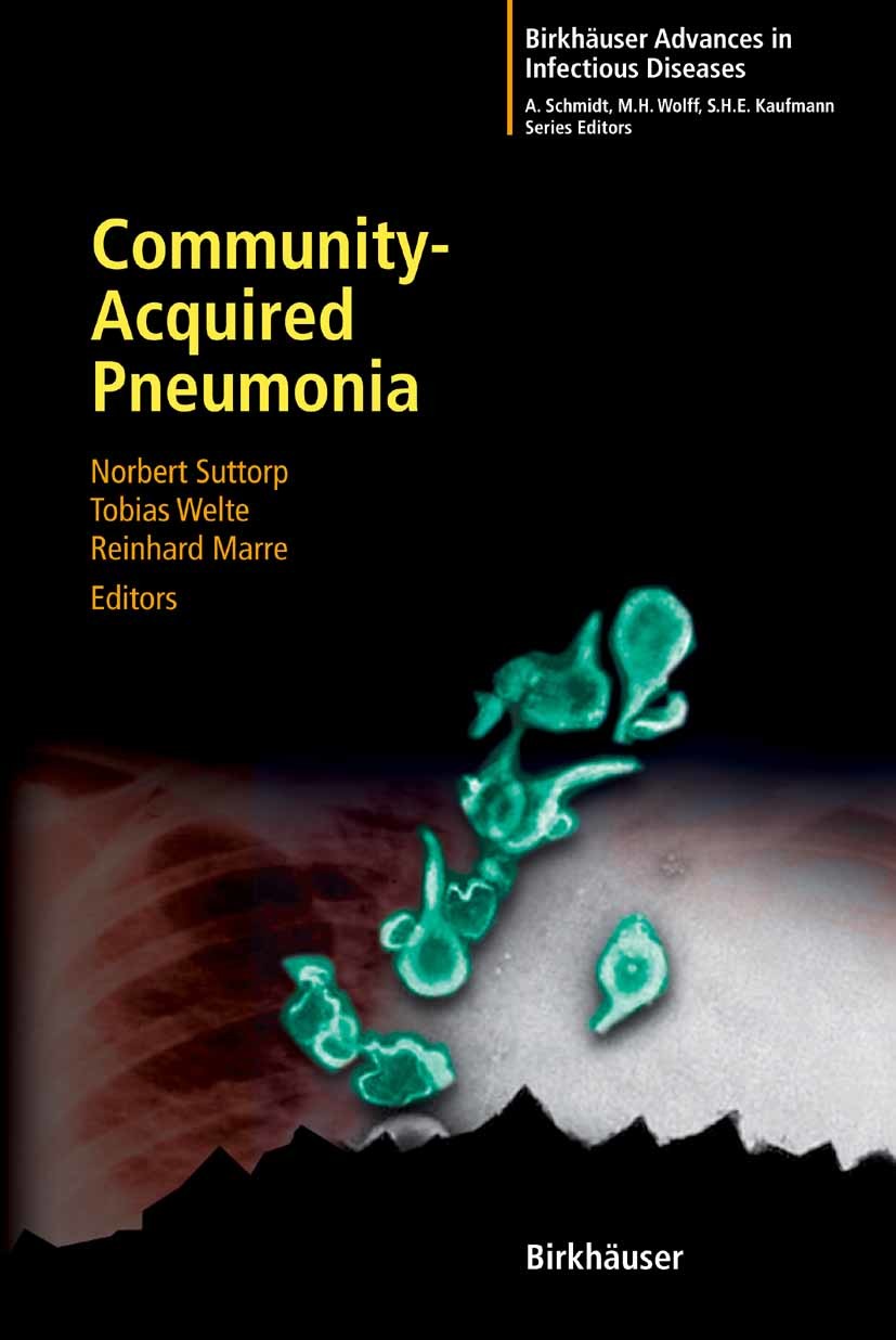 Cover Community-Acquired Pneumonia