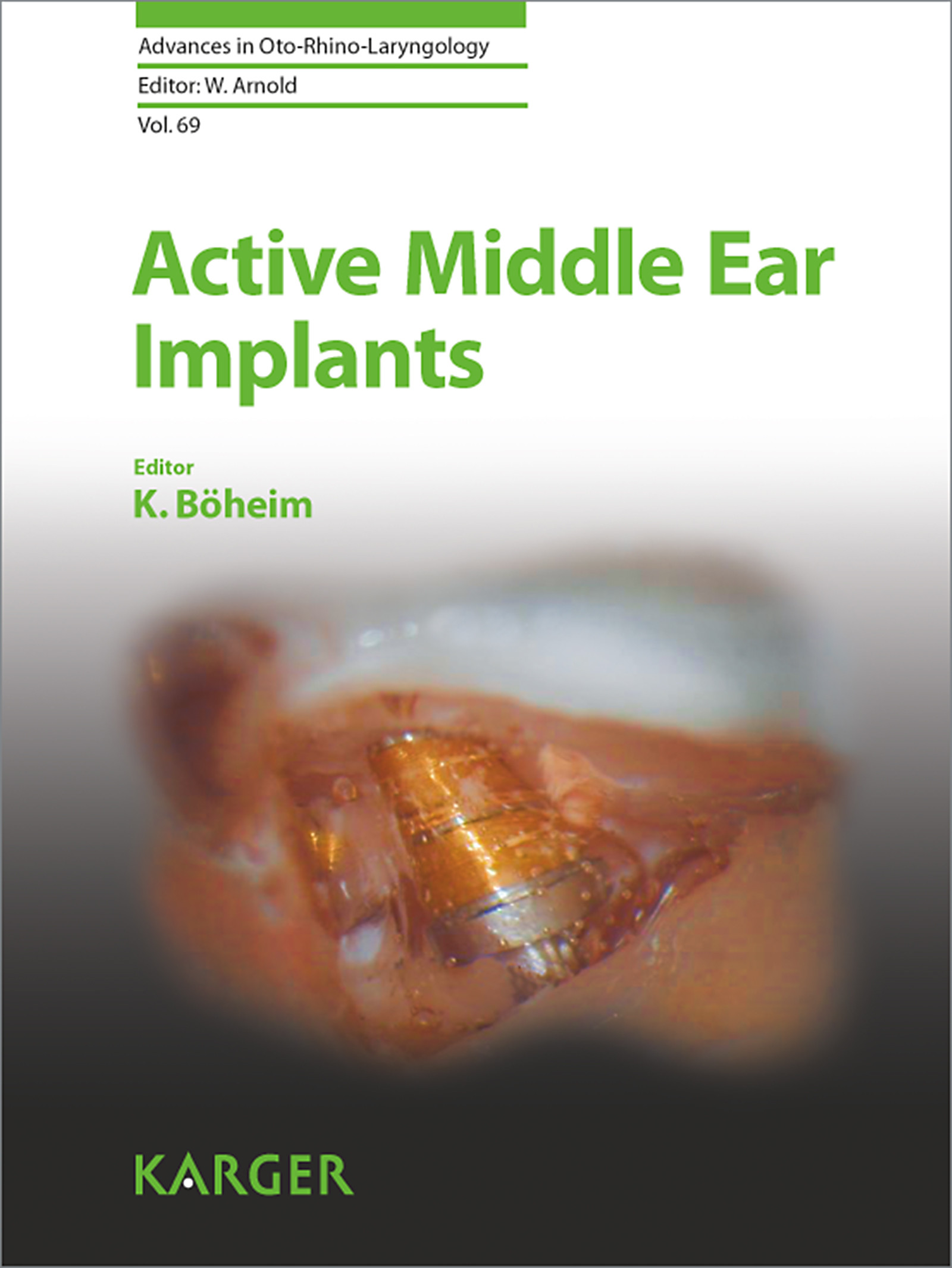 Cover Active Middle Ear Implants
