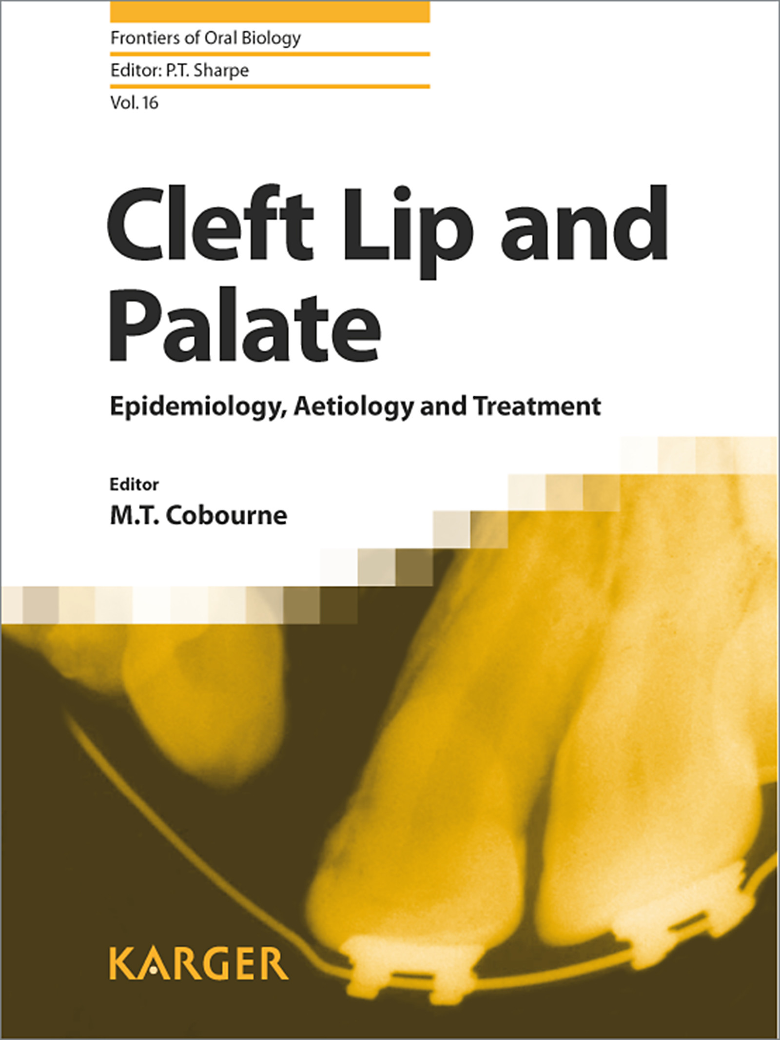 Cover Cleft Lip and Palate
