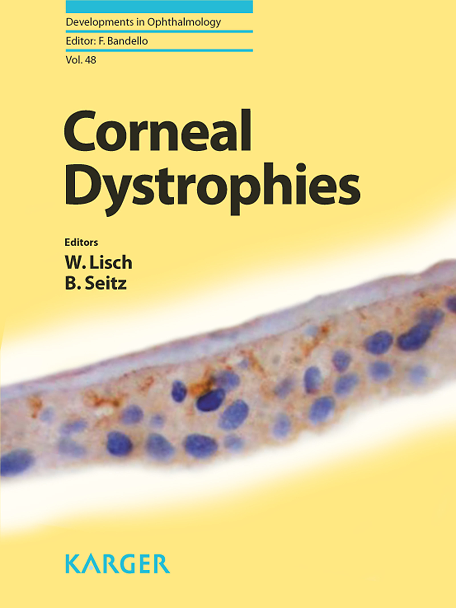 Cover Corneal Dystrophies