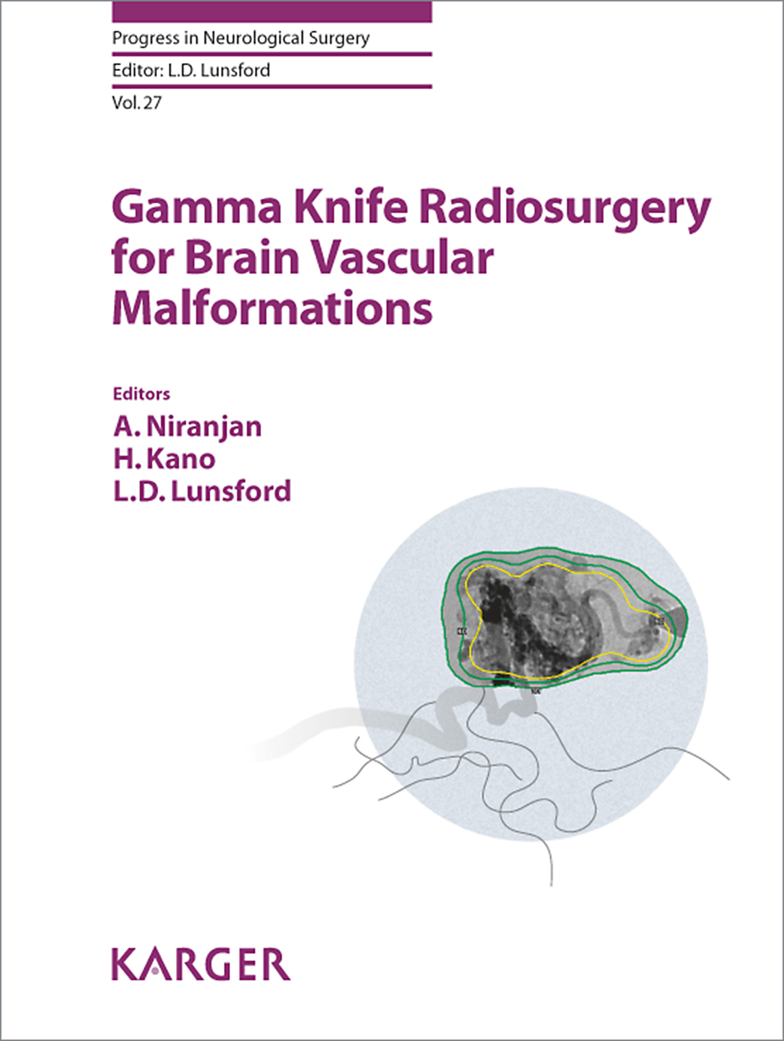 Cover Gamma Knife Radiosurgery for Brain Vascular Malformations
