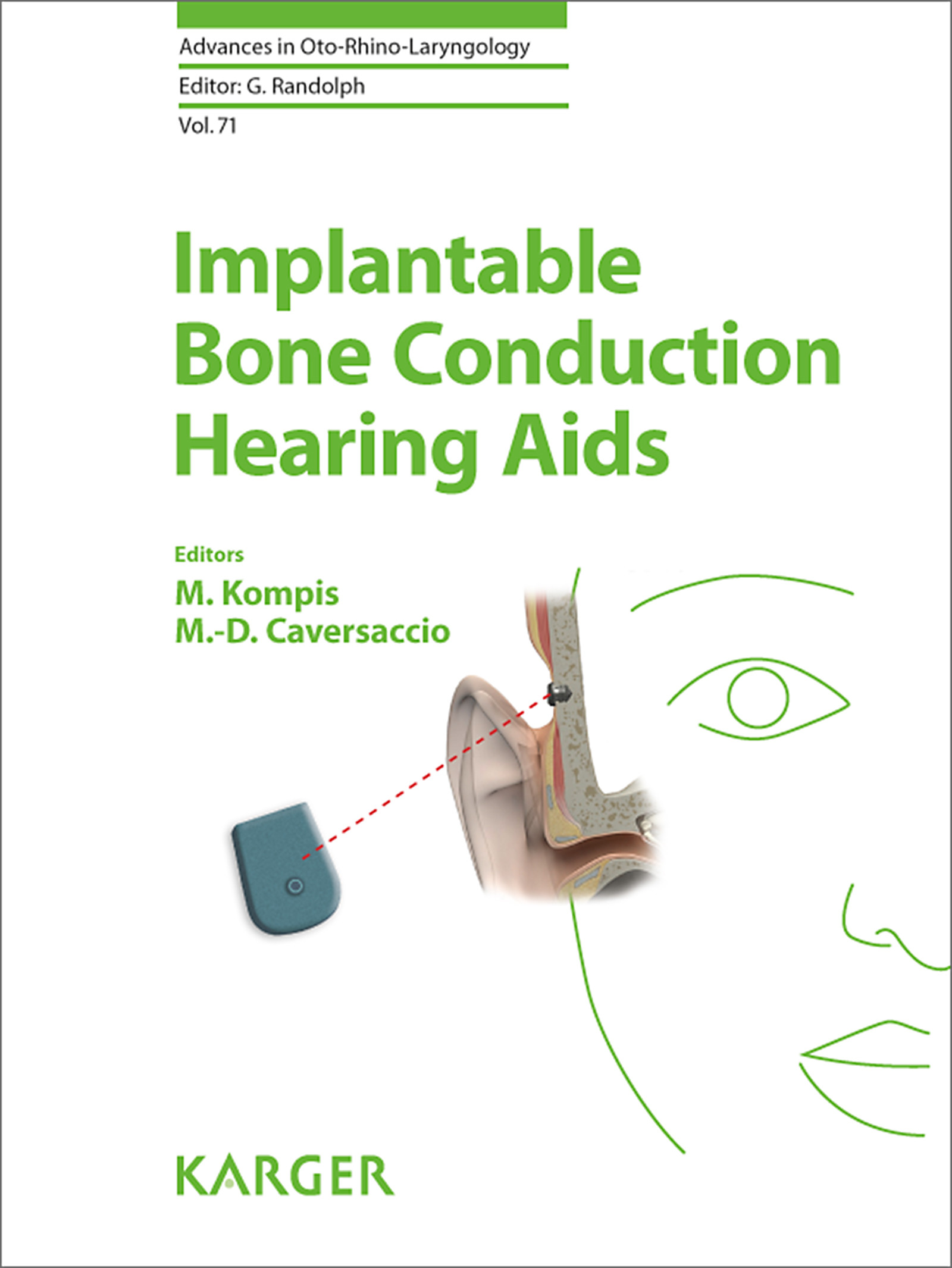 Cover Implantable Bone Conduction Hearing Aids
