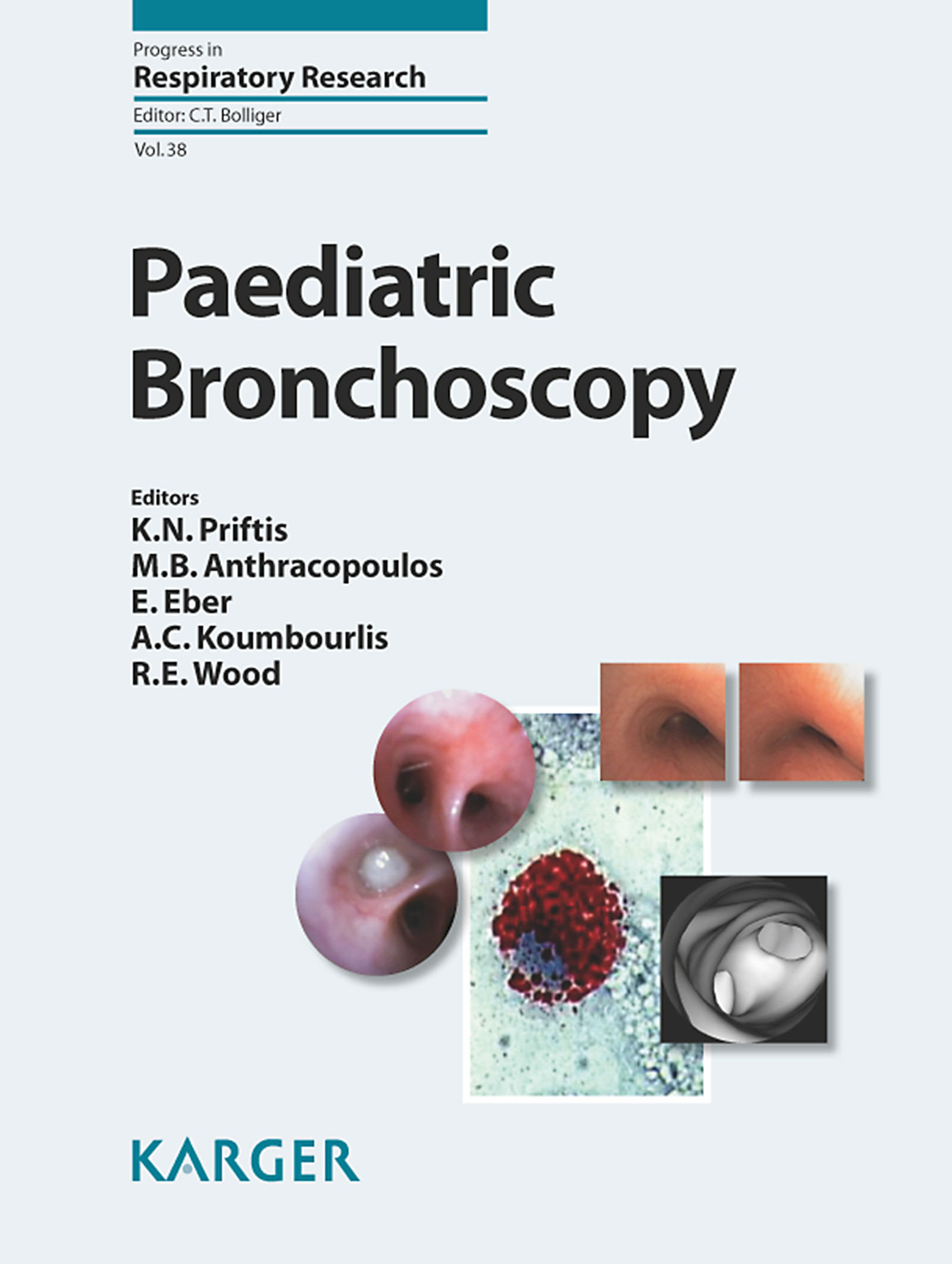 Paediatric Bronchoscopy