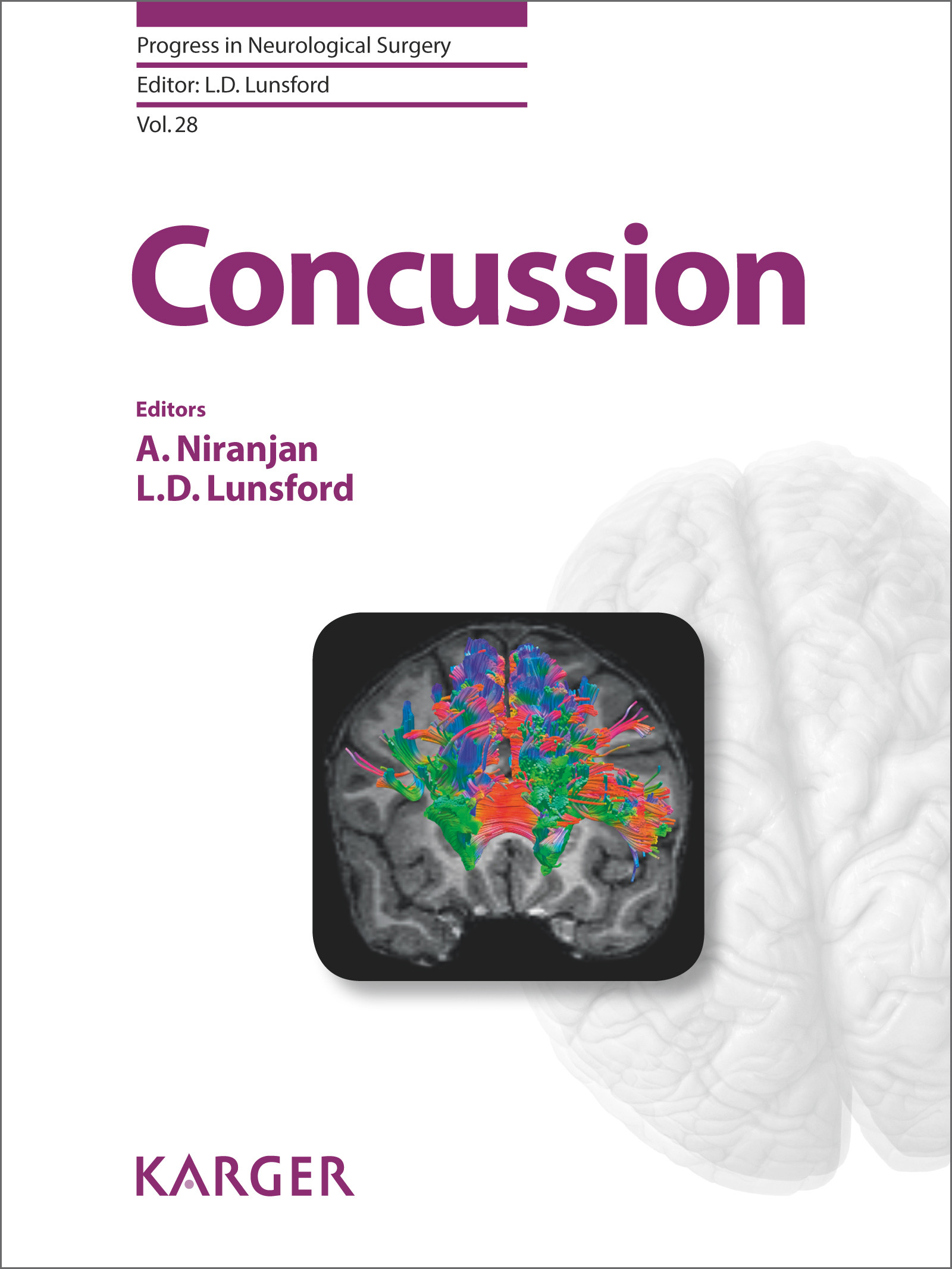 Cover Concussion