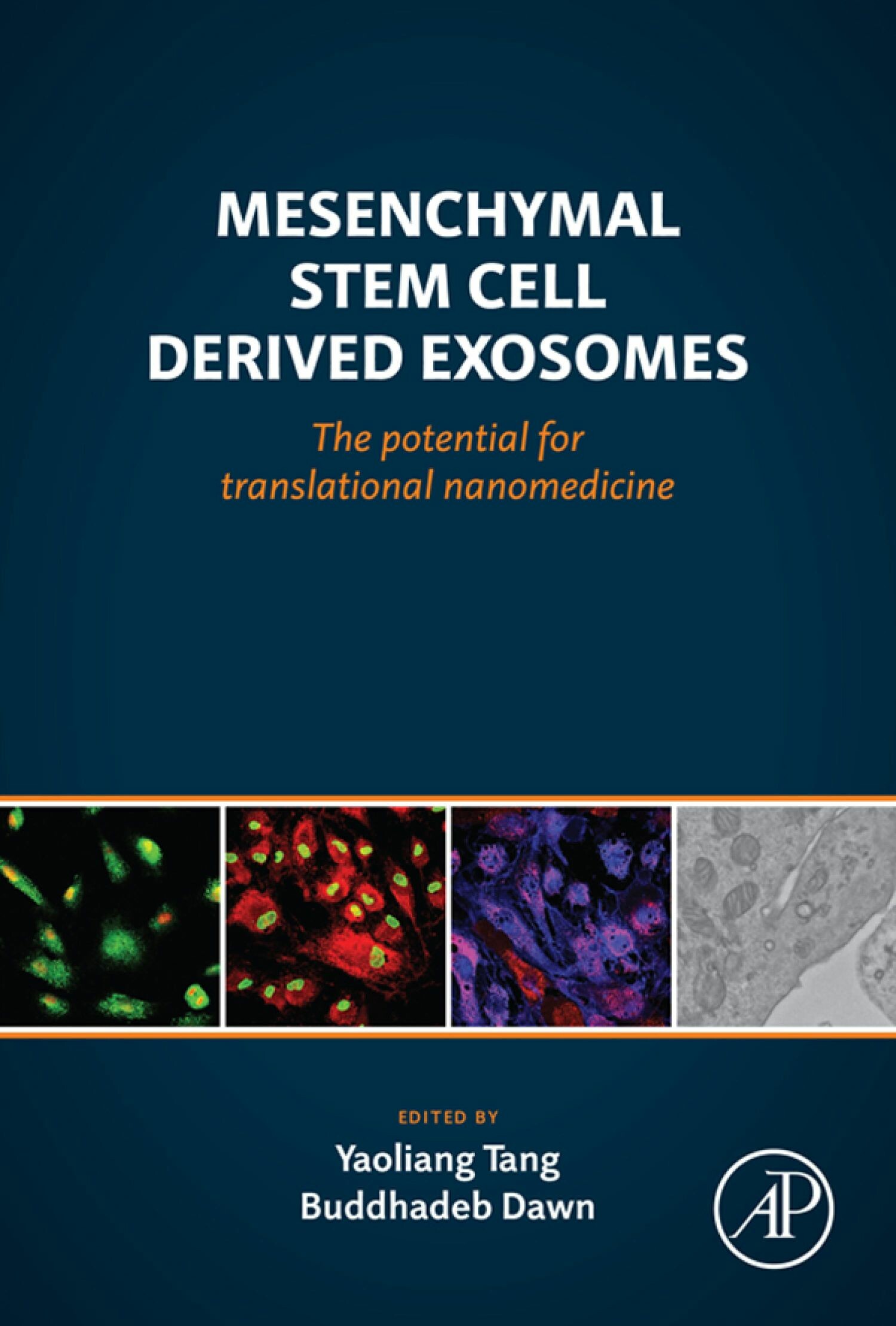 Cover Mesenchymal Stem Cell Derived Exosomes