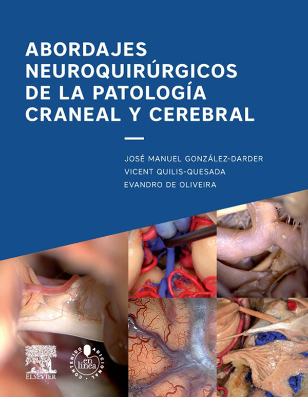 Cover Abordajes neuroquirúrgicos de la patología craneal y cerebral + acceso web