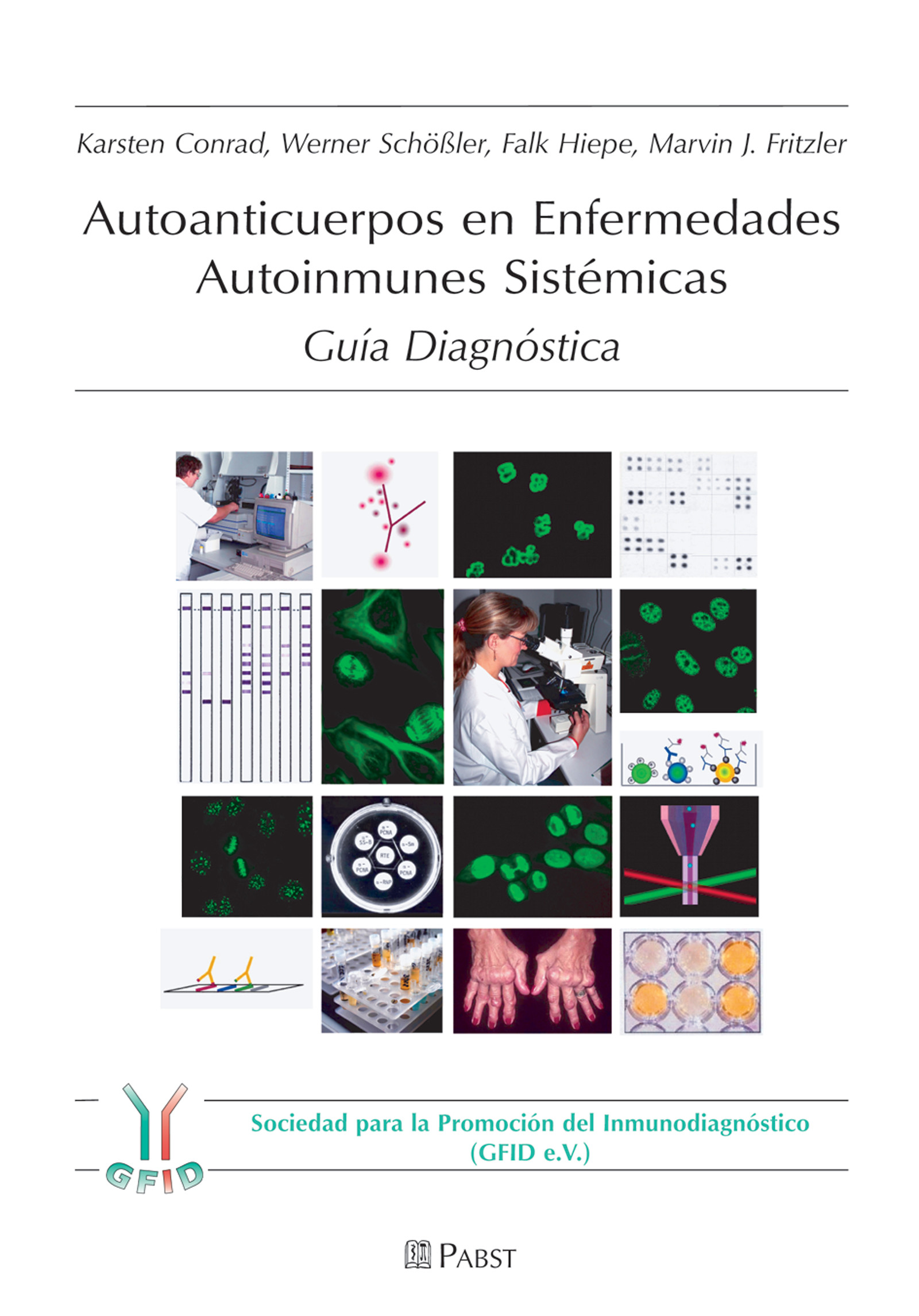 Cover Autoanticuerpos en Enfermedades Autoinmunes Sistémicas