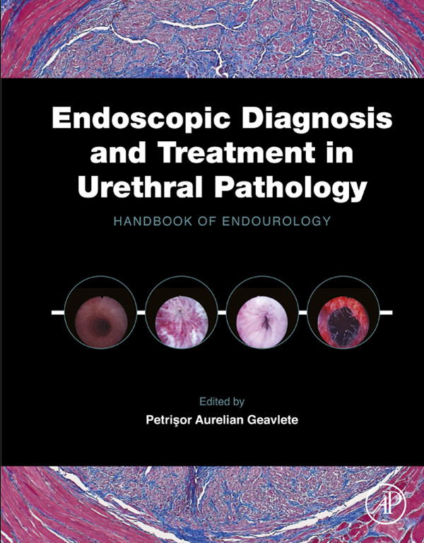 Cover Endoscopic Diagnosis and Treatment in Urethral Pathology