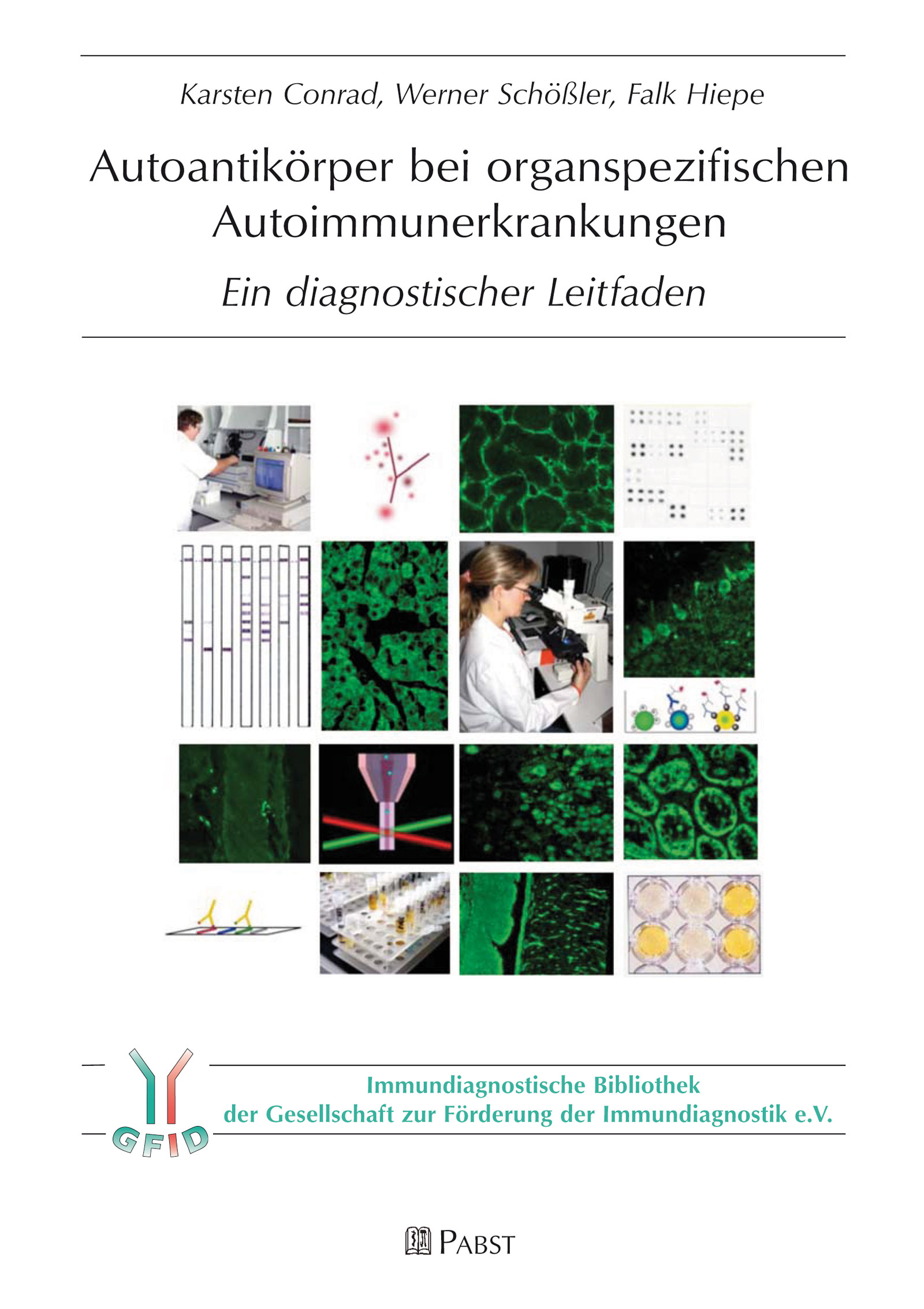 Autoantikörper bei organspezifischen Autoimmunerkrankungen