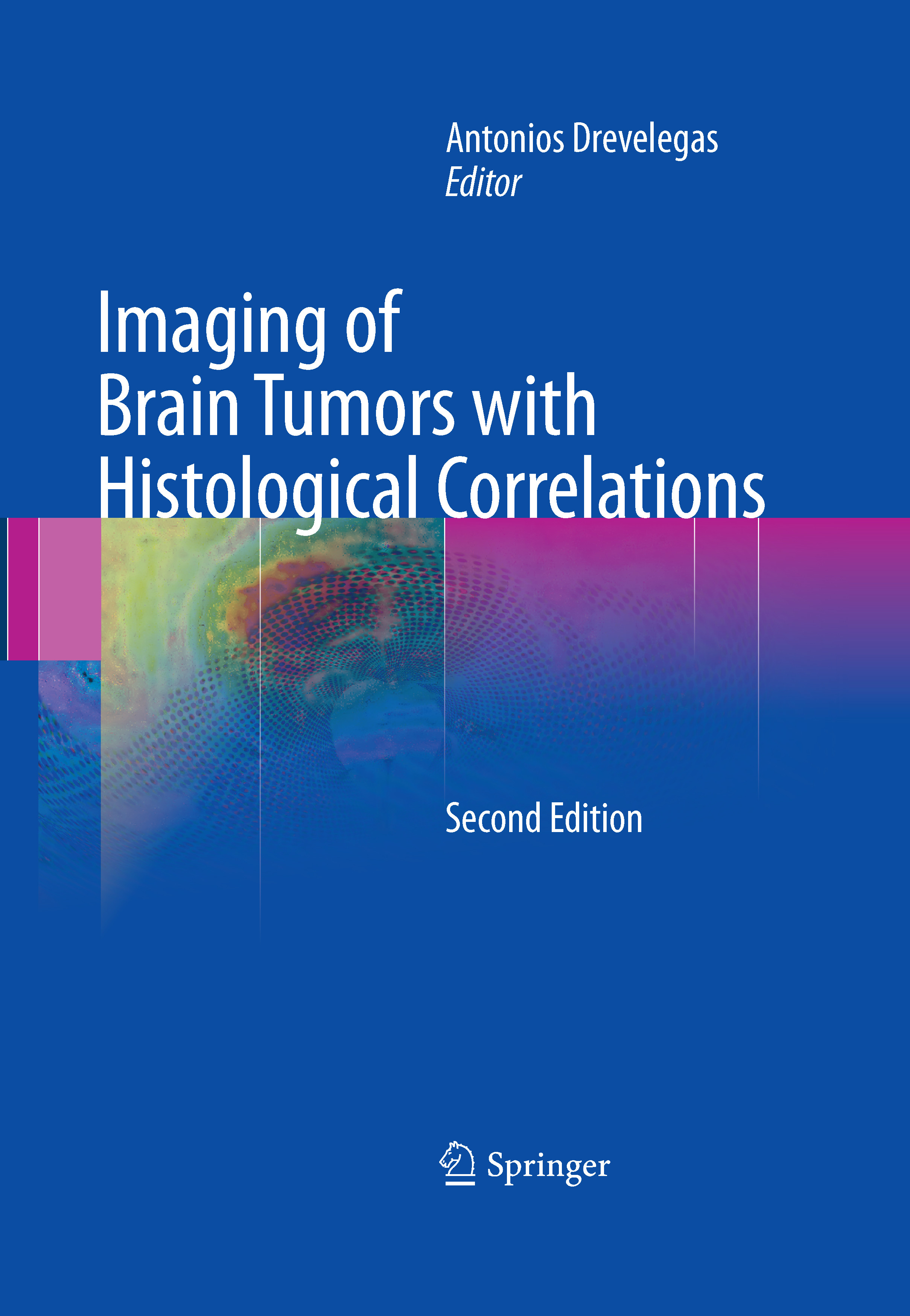 Cover Imaging of Brain Tumors with Histological Correlations