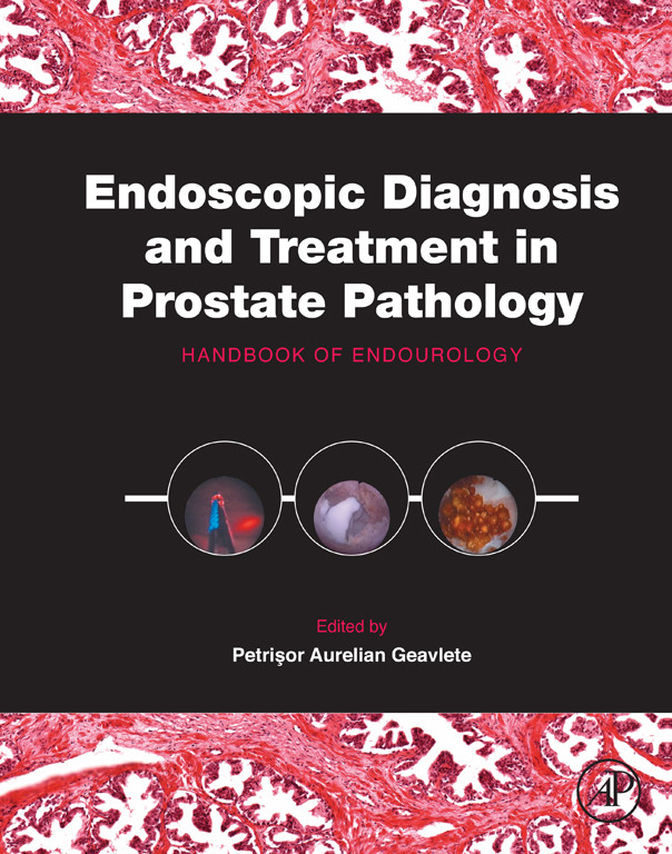 Cover Endoscopic Diagnosis and Treatment in Prostate Pathology