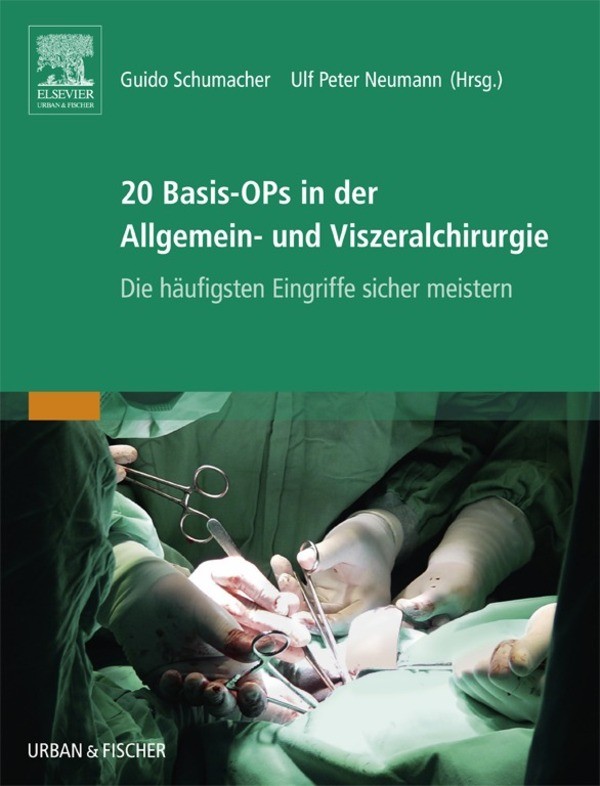 Cover 20 Basis-OPs in der Allgemein- und Viszeralchirurgie