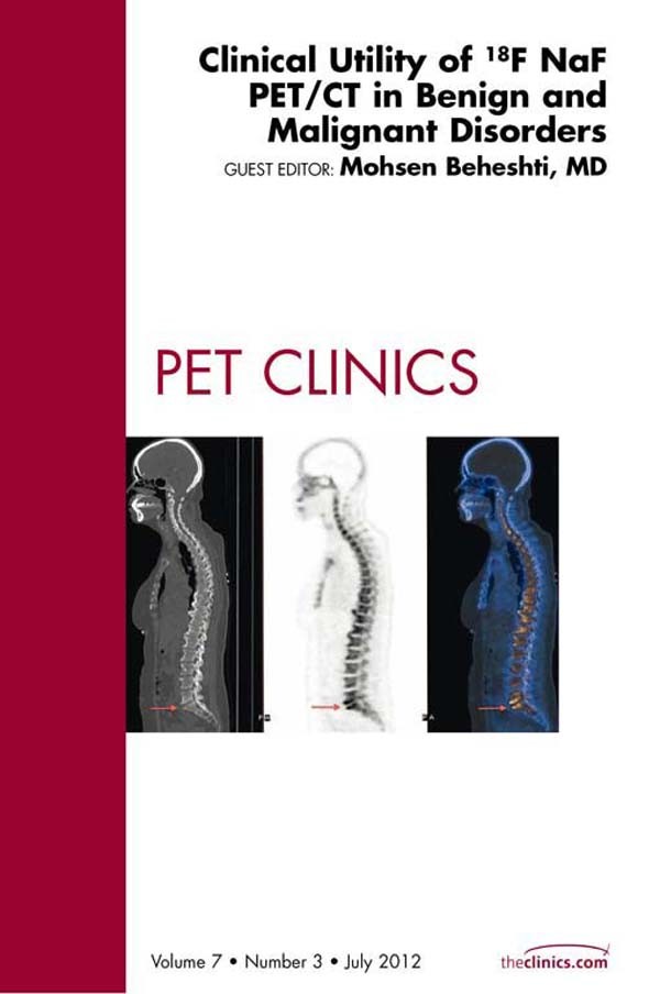 Clinical Utility of 18NaF PET/CT in Benign and Malignant Disorders, An Issue of PET Clinics