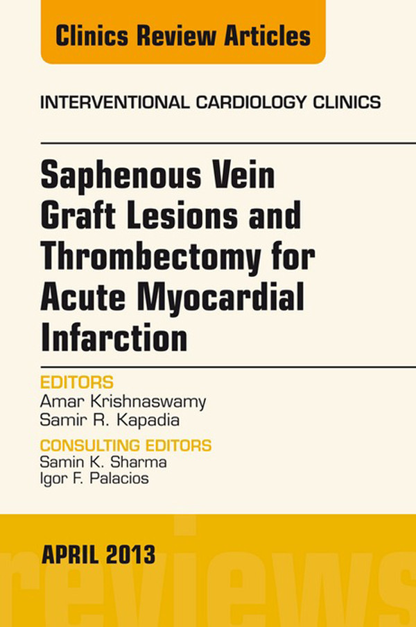 Cover Saphenous Vein Graft Lesions and Thrombectomy for Acute Myocardial Infarction, An Issue of Interventional Cardiology Clinics,