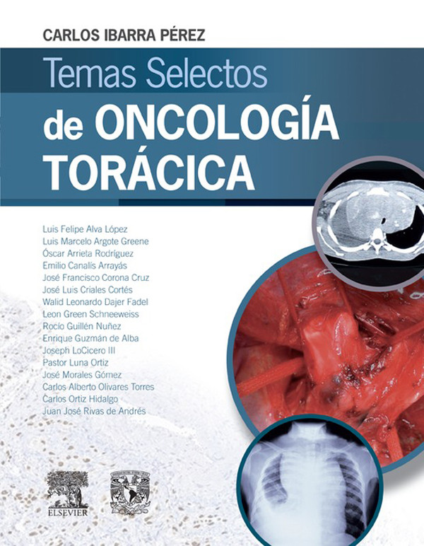 Cover Temas selectos de oncología torácica