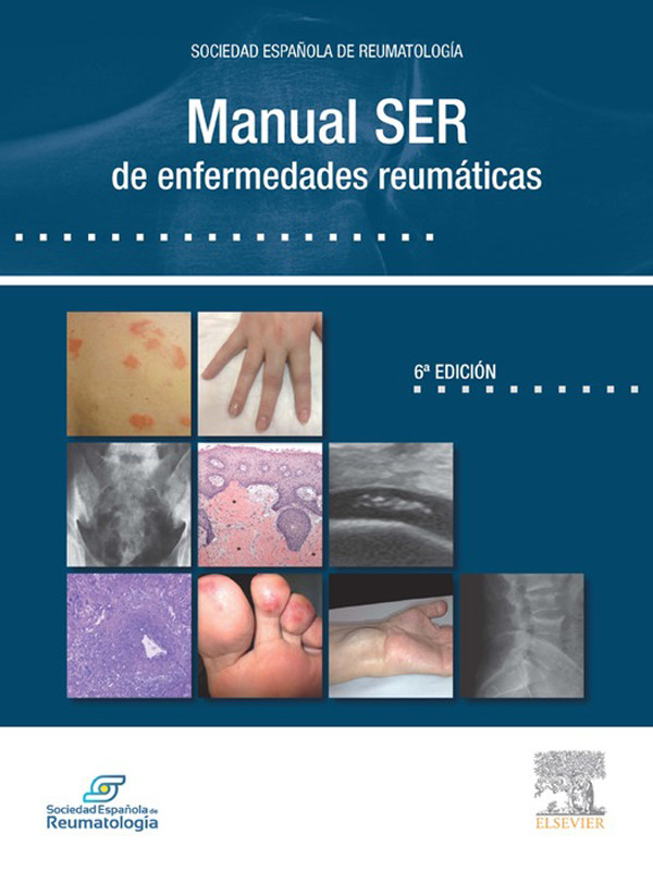 Cover Manual SER de Reumatología