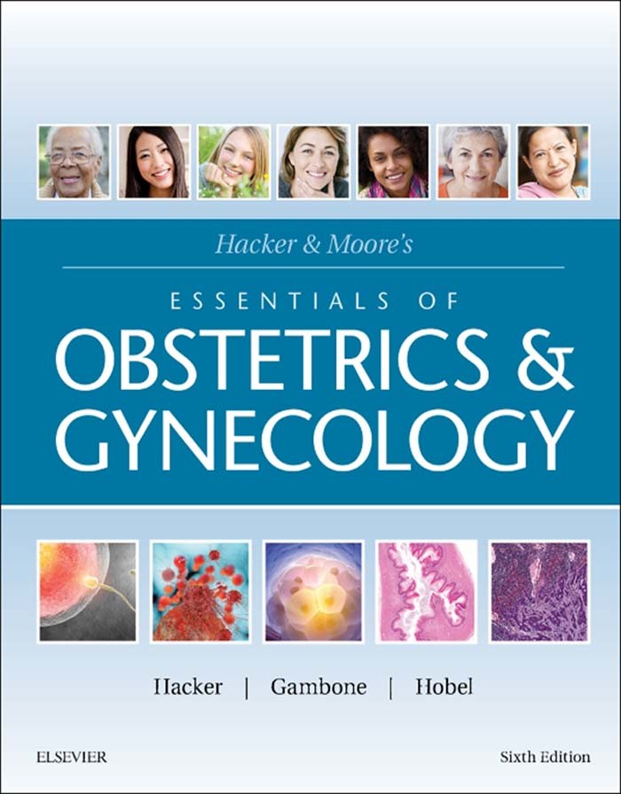 Hacker & Moore's Essentials of Obstetrics and Gynecology