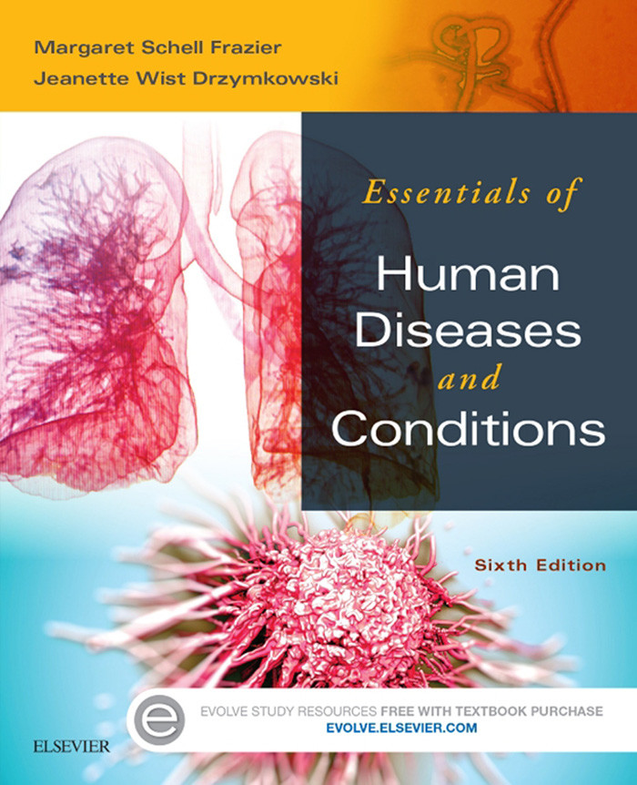 Essentials of Human Diseases and Conditions