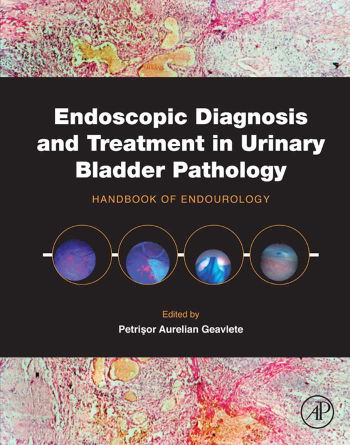 Cover Endoscopic Diagnosis and Treatment in Urinary Bladder Pathology