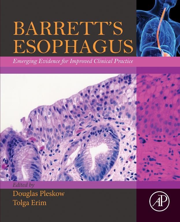 Barrett's Esophagus