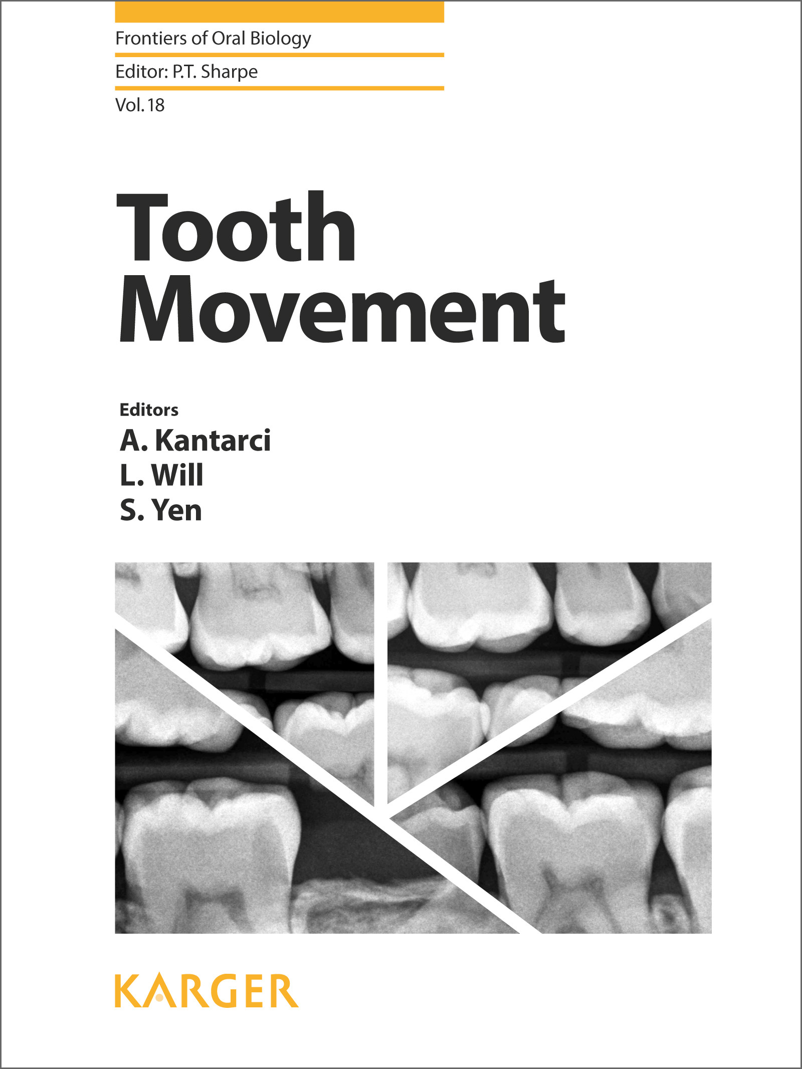 Cover Tooth Movement