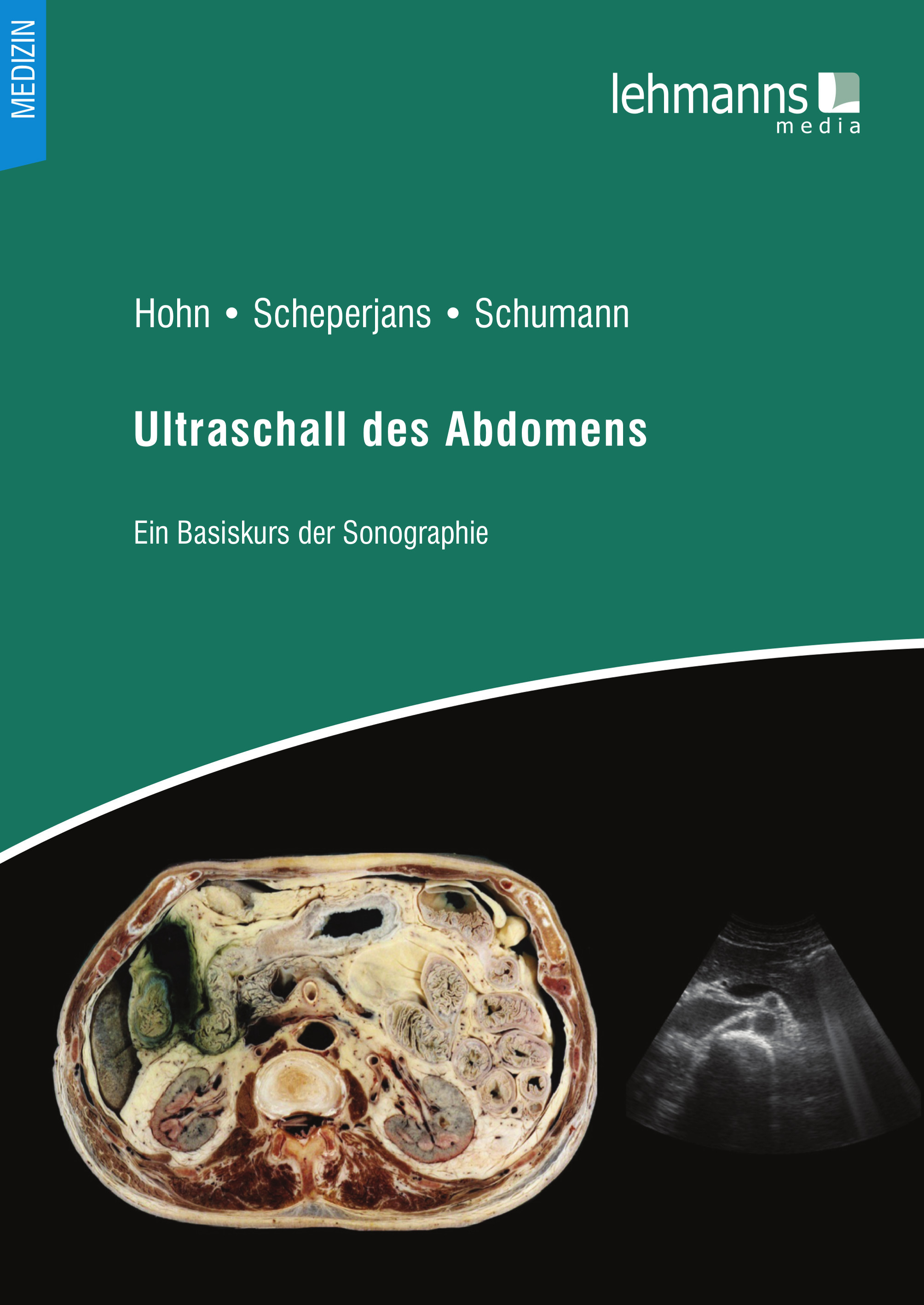 Ultraschall des Abdomens