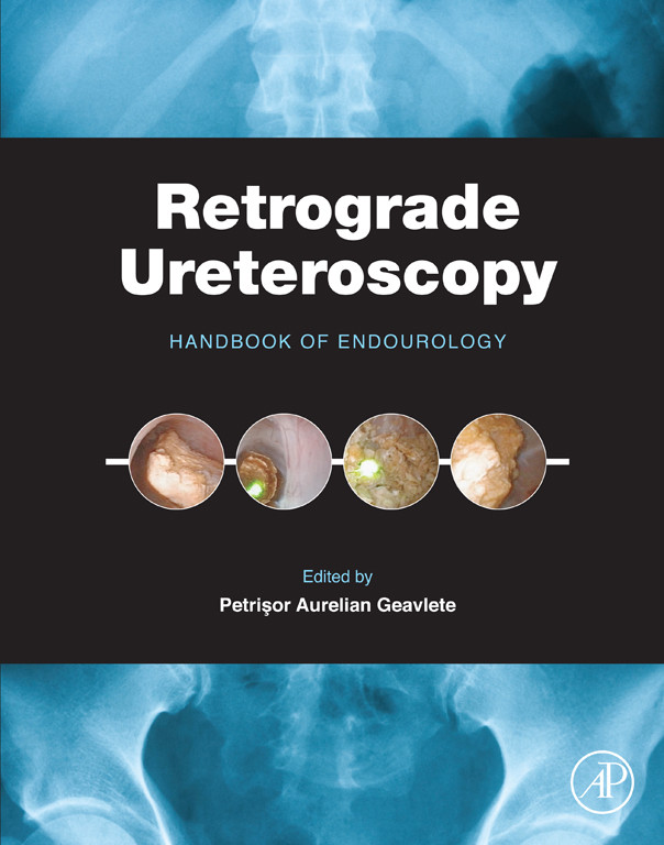 Cover Retrograde Ureteroscopy