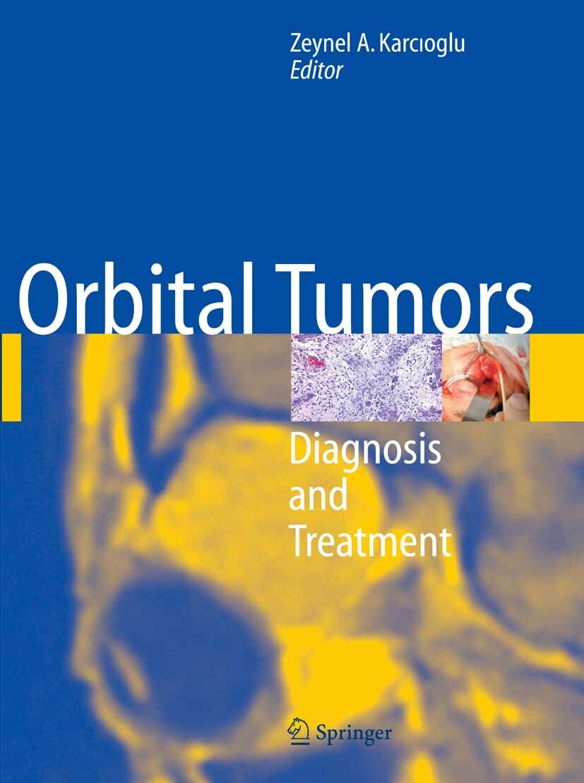 Cover Orbital Tumors
